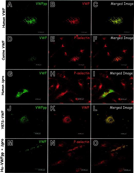 Figure 3. Expression of human or canine VWF proteins in canine VWD aortic endothelial cells. (A-F) Wild-type VWF. Canine VWD aortic endothelial cells were transiently transfected with either human VWF (A-C) or canine VWF (D-F) by nucleofection. Transfected cells were fixed, immunolabeled, and examined by confocal microscopy as described in “Materials and methods.” Cells were immunolabeled with a mix of several mouse monoclonal anti-VWFpp antibodies (A), a rabbit anti-VWF (B), AVW-1 mouse monoclonal anti-VWF (D), or rabbit anti–P-selectin (E). Immunostaining of cells expressing human VWF demonstrated a granular distribution of VWFpp and VWF (A-B). Merging the 2 images revealed colocalization of the proteins (C). Dual staining for VWF and P-selectin revealed that the canine VWF (D-F) colocalized with P-selectin in granules. Expression of canine VWF reestablishes the Weibel-Palade body distribution of endogenous P-selectin. (G-L) Dimeric VWF. Cells were transiently transfected with either a dimeric, propeptide-deleted VWF (Δpro) or dimeric, mutant Y87S-VWF. Cells were immunostained using the monoclonal anti-VWF, AVW-1 (G), rabbit anti–P-selectin (H), a mix of several mouse monoclonal anti-VWFpp antibodies (J) or polyclonal anti-VWF (K). Cells expressing human Δpro (G-I) showed diffuse VWF staining with no apparent VWF-containing granules (G). P-selectin distribution was unchanged (H), and the 2 proteins did not appear to colocalize (I). A dimeric, Y87S-VWF mutant was also transiently expressed in the canine VWD aortic endothelial cells (J-L). The mutant Y87S VWFpp and VWF showed a granular staining pattern in addition to diffuse staining and were found to colocalize (J-L). VWF multimerization is not necessary for Weibel-Palade body formation. (M-O) Coexpression of VWFpp and Δpro. Cells were transiently transfected with Δpro and VWFpp in trans as 2 separate constructs. Cells were immunostained using AVW-1 monoclonal anti-VWF (M) and rabbit anti–P-selectin (N). In cells expressing VWF, P-selectin was found to colocalize with VWF in granules (O). Coexpression of VWFpp and Δpro generates Weibel-Palade bodies in canine VWD aortic endothelial cells.