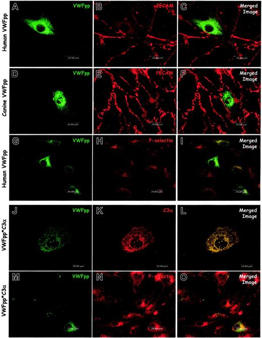 Figure 5. VWFpp alone does not induce Weibel-Palade body formation. The VWFpp and the fusion protein VWFpp*C3α were independently expressed in canine VWD aortic endothelial cells. Transfected cells were processed and examined as described in “Materials and methods.” Cells were immunostained with a rabbit anti-VWFpp (A, D), a mix of several monoclonal anti-VWFpp antibodies (G, J, M), mouse anti-PECAM (B, E), rabbit–anti-P-selectin (H, N), or polyclonal anti-C3 antibody (K). In cells expressing either human VWFpp (A-C) or canine VWFpp (D-F), the distribution of VWFpp was diffuse, although small VWFpp-containing granules were occasionally observed (D). Cells expressing human VWFpp were dual stained for VWFpp (G) and P-selectin (H): P-selectin distribution was unchanged compared with untransfected VWD endothelial cells and very little colocalization of VWFpp and P-selectin was observed (I). Cells expressing the VWFpp*C3α fusion protein showed both diffuse staining as well as granular storage of both VWFpp (J) and C3α (K). Dual-staining for VWFpp (M) and P-selectin (N) revealed very little colocalization of the VWFpp*C3α protein with P-selectin (O). While the VWFpp*C3α protein may induce granule formation in the canine VWD aortic endothelial cells, P-selectin is not recruited to the newly formed granule.