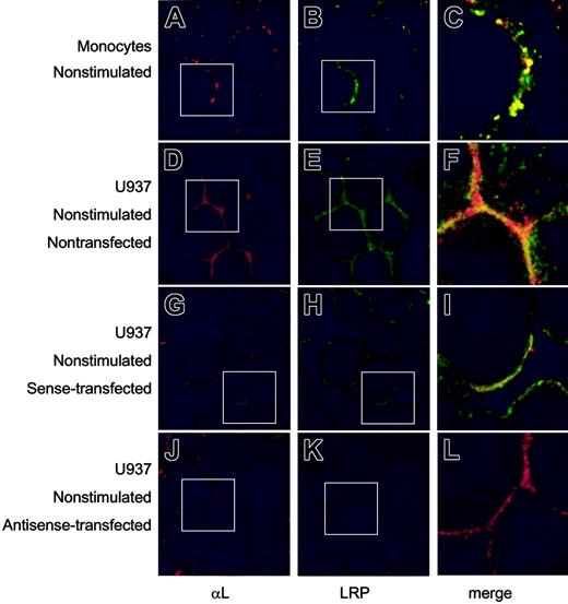 Figure 4. Surface expression of LRP and αL-subunit in monocytes and U937 cells. Freshly isolated monocytes (A-C), nontransfected U937 cells (D-F), and U937 cells transfected with sense (G-I) or antisense LRP oligonucleotides (J-L) were collected on object glasses by cytospin centrifugation (105 cells/spin). After fixation, αL-subunit (A, D, G, J) was visualized using monoclonal antibodies and a Texas Red–labeled secondary antibody. LRP (B, E, H, K) was detected using polyclonal antibodies and an FITC-labeled secondary antibody. Original magnification, × 250. (C, F, I, L) Enlarged merge images; original magnification, × 750. White boxes indicate the positions of the enlarged merge images.