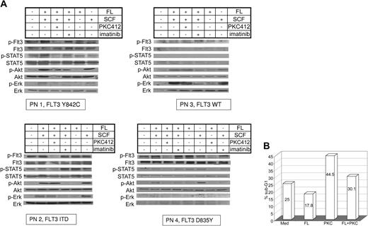 Figure 2. Signal transduction patterns of mutated and wt-Flt3 in primary AML cells and cell cycle analysis. (A) PB was taken before start with PKC412. MNCs were separated and treated with FL (100 ng/mL), SCF (100 ng/mL), 100 nM PKC 412, imatinib mesylate (1 μM) and in combination for 15 minutes as indicated. Whole-cell lysates were analyzed by Western blot. Constitutive tyrosine phosphorylation of FLT3 and STAT-5 in primary AML blasts harboring mutated FLT3 using specific antiphosphotyrosine antibodies for FLT3 and STAT-5 was detected. Akt and Erk1/2 activation were investigated using specific antiphosphoserine-Akt and antiphosphotyrosine-Erk antibodies, respectively. Further, FL or SCF effects on the investigated signaling pathways are demonstrated. To control equal loading, the blot was stripped and reprobed. (B) Primary MNCs obtained from AML patient PN 1 were maintained in RPMI 1640 without any growth factor supplementation and incubated with or without PKC412 (50 nM), FL (100 ng/mL), or in combination for 90 hours as indicated, and cell cycle analysis was performed.