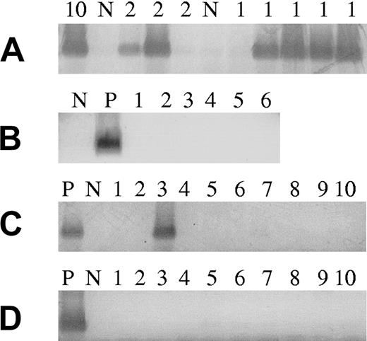 Figure 1. Detection of K-RAS61 mutations using ACB-PCR. (A) Sensitivity of ACB-PCR when analyzing FACS-sorted PCs. FACS sorting of 1, 2, or 10 MM PCs from a patient with a K-RAS61 mutation to PCR tubes containing 100 FACS-sorted CD19+ B cells from a healthy donor. In 4 of 5 PCR tubes with a single FACS-sorted K-RAS61+ MM PC among 100 normal B cells, a K-RAS61+ MM PC was detected. (B) From all patients with an N-RAS61 mutation, 100 PCs were analyzed. (C) Patients that did not have any RAS mutations detectable by direct sequencing were analyzed (10 cases shown) and a single patient was identified as positive. All MGUS patients were analyzed and all were found to be negative for K-RAS61 mutations (10 cases shown). P indicates positive control, 100 FACS-sorted PCs from a patient with a K-RAS61 mutation. N indicates negative control, 100 FACS-sorted CD19+ B cells from a healthy donor.