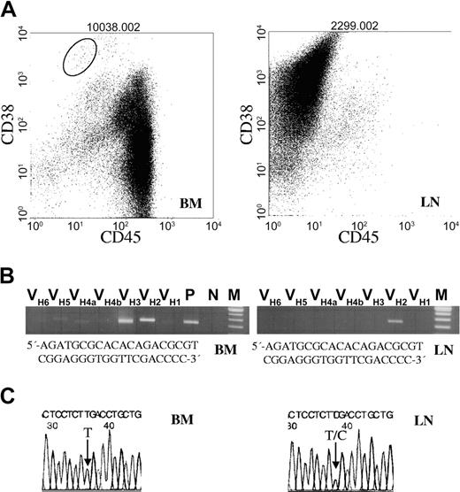 Figure 2. Genetic analyses on flow-sorted PCs. (A) CD45 versus CD38 flow dot plot of BMMNCs and lymph nodes (LNs) from a patient with extramedullary myeloma (ExMM-8; Table 3). The PCs from both locations expressed high levels of CD56 and were CD19- (data not shown). The sort gate used for generating pure CD38++/CD45-/CD56++/CD19- PCs to RAS mutational analysis is shown. (B) The VHDJH gene rearrangements representing the MM clone were identified by RT-PCR using consensus VH and JH primers. Among BMMNCs a polyclonal VH3 (originating from normal B cells) and a clonal VH2 band was identified. The LN population consisted of a VH2 clone. To verify clonal identity the VHDJH gene was sequenced, showing identical complementarity-determining region (CDR) I, II, and III sequences. The CDRIII sequence is shown in panel B. (C) Direct sequencing of RAS RT-PCR products generated from BM- and LN-localized CD38++/CD45-/CD56++/CD19- PCs purified by flow sorting. The reverse sequence is shown including codon K-RAS61, with a single K-RAS61 mutation CAA to CGA in the LN. Arrows show places of mutations.