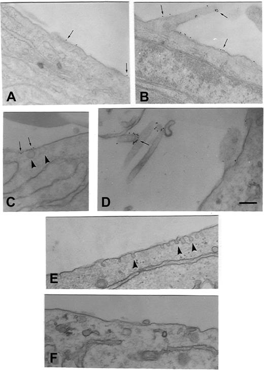 Figure 1. Ultrastructural localization of TF in fibroblasts and loss of caveolar structure on cholesterol depletion. Fibroblasts (WI-38 cells) were fixed and immunostained with TF mAb as described in “Materials and methods” (A-D). TF was localized on the cell membrane (A), on cellular processes (B), and in caveolae (C). The tip of a cellular process that was in contact with other cell/cellular process are stained densely for TF (D). Thin arrows point out gold particles, whereas arrowheads point out caveolae. Monolayers of WI-38 fibroblasts were treated with a control vehicle (E) or mβCD (10 mM) (F) for 45 minutes at 37°C. The cells were then fixed, sectioned, stained, and viewed under transmission electron microscope. Bar indicates 200 nm.