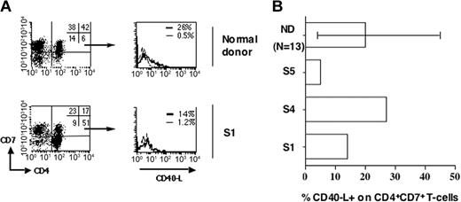 Figure 3. Conserved CD40L induction on normal polyclonal CD4+CD7+ cells of patients with SzS. (A) PBMCs were activated with anti-CD3. After 6 hours, cells were immunostained for CD40L, CD4, and CD7 and analyzed by flow cytometry. Dot plots show CD4 and CD7 expression for a healthy donor and patient S1 with a CD4+CD7-tumor (left panels). The percentage of labeled cells for each quadrant is indicated in the upper right quadrant. Histograms representing CD40Lexpression on unstimulated (thin lines) and anti-CD3-stimulated (thick lines) gated CD4+CD7+ T cells are shown (right panel). (B) CD4+CD7+ nontumor T cells were analyzed as in panel A for CD40L expression upon anti-CD3 stimulation. Percentage of CD40L+ cells obtained in the CD4+CD7+ T-cell fraction of healthy donors (n = 13) and patients with SzS (n = 3) is shown. Minimum and maximum values obtained with healthy donors are indicated.