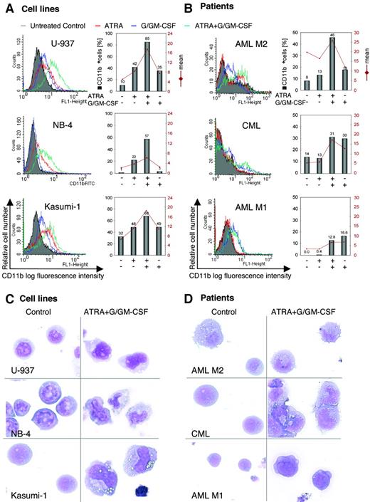 Figure 1. Induction of myelomonocytic differentiation by ATRA and/or G/GM-CSF in myeloid leukemia cell lines and patient samples. (A,B) Flow cytometric detection of CD11b expression using FITC-labeled mouse anti-human CD11bmAb. After 3 days of treatment with differentiating agents (as indicated), the numbers of CD11b cells (above bars) and the mean values of CD11b fluorescence intensity (red line) were determined compared with untreated control cells. Three different cell lines (A) and 3 patient samples (B) have been investigated with 10 000 (A) and 5000 (B) viable cells being analyzed in each case. IgG1-negative control levels were deducted from all values. (C,D) Morphological appearance following May-Grünwald staining of myeloid leukemia cell lines (C) and patient cells (D), which were treated with ATRA and G/GM-CSF for 5 days or untreated (control). Original magnification: × 63.