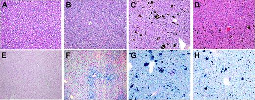 Figure 1. Histologic examination of the liver. Four-month-old wild-type and homozygous TfR2 Y245X mutant female sibling mice were injected with either PBS or 5 mg iron-dextran intraperitoneally twice a week for 3 weeks. One week after the last injection, the livers were subjected to histologic analysis. (A, E) The liver of a PBS-treated wild-type mouse. (B, F) The liver of a PBS-treated homozygous TfR2 Y245X mutant mouse. (C, G) The liver of an iron-loaded wild-type mouse. (D, H) The liver of an iron-loaded homozygous TfR2 Y245X mutant mouse. (A-D) Hematoxylin eosin staining. (E-H) Perl Prussian blue staining for the detection of iron storage. Original objective magnification of these panels was × 20.