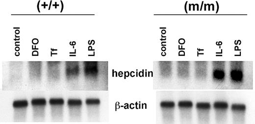 Figure 3. Expression of hepcidin mRNA in isolated hepatocytes. Hepatocytes from either wild-type (+/+) or homozygous TfR2 Y245X mutant (m/m) mice were cultured for 48 hours in culture medium alone (control), DFO, iron-saturated Tf, IL-6, or LPS; their RNA was extracted and Northern blotted using murine hepcidin and β-actin probes.