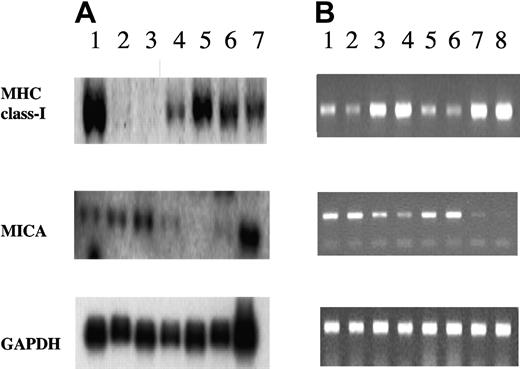 Figure 3. Northern blot and RT-PCR analysis of MHC-I and MICA expression in myeloma cell lines. (A) Northern blot analysis. Total RNA (10 μg) from T2 (lane 1), KMS21BM (lane 2), KMS12BM (lane 3), KMS12PE (lane 4), KMS26PE (lane 5), KMS11PE (lane 6), and HeLa (lane 7) cell lines was hybridized with MHC-I and MICA cDNA fragments. For the evaluation of gel load and transfer, the same filters were rehybridized with a fragment of GAPDH cDNA. Reciprocal amounts of MHC class I heavy chains and MICA transcripts levels were observed between BM and PE myeloma cell lines. (B) RT-PCR was performed from RNA preparations in duplicate, using specific primers for MHC class I, and MICA (40 cycles). cDNAs were obtained from: KMS12BM (lanes 1-2), KMS12PE (lanes 3-4), KMS21BM (lanes 5-6), and KMS21PE (lanes 7-8). The products were analyzed by agarose gel and were normalized using the levels of GAPDH (20 cycles) as an internal control. The RT-PCR analysis confirmed the inverse correlation between the MHC class I and MICA transcript levels found in BM and PE cell lines.