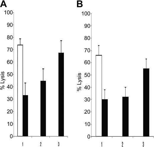 Figure 4. MHC class I inhibits NK cell recognition of pleural effusion-derived myeloma cell lines. Mean NK lysis percentage of KMS12BM and of KMS12PE are reported in panel A, while NK lysis of KMS21BM and KMS21PE are reported in panel B. BM and PE myeloma cell lysis are indicated with white and black columns, respectively. Antibody pretreatment of the PE targets are reported on abscisses: 1) complete medium, 2) anti-CD57 (TIB200) isotype control, 3) anti-MHC class I mAb A6 to 136 (IgM). The percentage of lysis reported was calculated with E/T ratio of 12:1. MHC class I masking restored myeloma susceptibility to NK recognition.