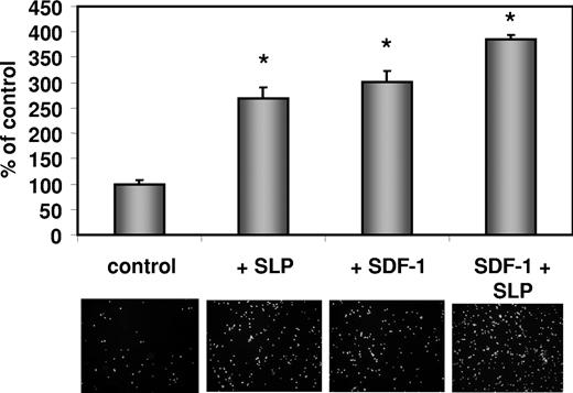 Figure 5. Stimulation of CB CD34+ cell adhesion to HUVECs by SLPs. Calcein-AM–labeled CD34+ cells were not preincubated (left panel) or were preincubated with SLPs (3% vol/vol) (right panel) or with SDF-1 and subsequently were layered over HUVECs. After 30 minutes, nonadherent cells were removed, and adherent cells were counted using a spectrophotofluorimeter. (Upper panel) Relative fluorescence intensity. (Lower panel) Inverted microscope analysis of fluorochrome-labeled adhered cells. Cells were examined using Nikon Eclipse TS100 inverted microscope equipped with ELWD epifluorescence attachment (Nikon Instruments Inc., NY, USA), and digital images were captured using an Olympus DP10 camera (Olympus America). Original magnification 100 × (objective 20 ×, N.A 0.45). Data from 3 separate experiments were pooled together. Values shown are mean ± SD. *As compared with SDF-1 low dose.