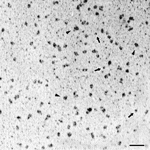 Figure 3. Transmission electron microscopy of rotary shadowed PF4-heparin complexes. Fields demonstrating the appearance of PF4-heparin complexes at the optimal PF4-heparin ratio. Triangles (▸) indicate representative ULCs; arrows point to representative SCs. The coating of metal from the shadowing technique makes the extended structure of the IgG appear artificially larger in comparison to that of compact structure of the PF4-heparin complexes. Magnification bar = 50 nm.