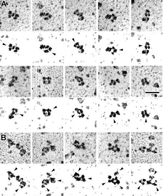Figure 6. Transmission electron microscopy of rotary shadowed PF4-heparin complexes with KKO antibody bound. Galleries showing the appearance of PF4-heparin complexes with KKO antibody bound. IgG molecules have a typical 3-lobed structure, but their appearance can vary widely because they are quite flexible molecules. (A) Examples of PF4-heparin complexes with a single KKO bound. (B) Examples of PF4-heparin complexes with multiple KKO antibodies bound to each. Below each frame is very high contrast image to highlight the shadowed molecules and eliminate the background. Arrows point to the antibodies. Magnification bar = 50 nm. Adobe Photoshop 7.0 (Adobe, San Jose, CA) was used to produce high-contrast images.