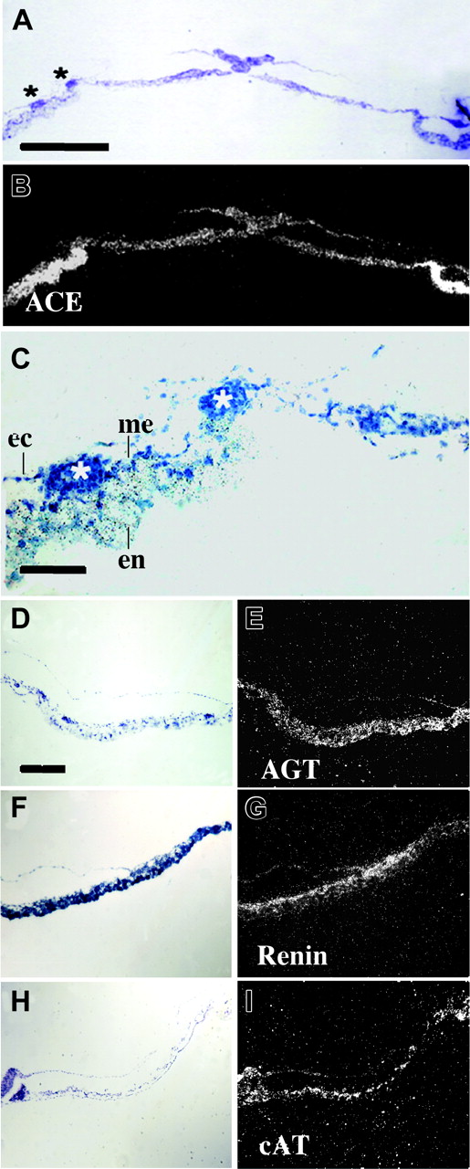 Figure 4. Expression of ACE, AGT, renin, and cAT mRNAs during blood island differentiation (stage HH8). Transverse sections in the posterior half of the blastodisc at 29 hours of development (stage HH8) for in situ hybridization. (A-B) ACE expression in the extraembryonic endoderm. (C) Blood islands differentiating in the mesoderm (me), between the ectoderm (ec), and ACE-producing cells in the endoderm (en). Asterisks indicate blood islands (higher magnification of the view from panel A). For comparison, panels D and E show the expression of AGT, panels F and G, the expression of rennin; and panels H and I, the expression of cAT. (A,C,D,F,H) Bright-field illumination. (B,E,G,I) Dark-field illumination. (A-B) Original magnification, × 9; type of the objective lenses, EF × 4; numerical aperture 0.12. (C) Original magnification, × 60; type of the objective lenses, PL APO × 25; numerical aperture 0.70. (D-I) Original magnification, × 22; type of the objective lenses, EF × 10; numerical aperture 0.26. Scale bar: 500 μm (A-B), 100 μm (C), 200 μm (D-I).