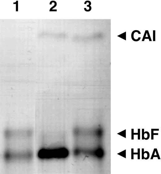 Figure 4. Cellulose acetate electrophoresis. Cell lysates from control (lane 1), EPO (lane 2), and EST (lane 3) samples from matched cultures are shown. The locations of carbonic anhydrase (CAI), fetal hemoglobin (HbF), and adult hemoglobin (HbA) bands are indicated on the right.