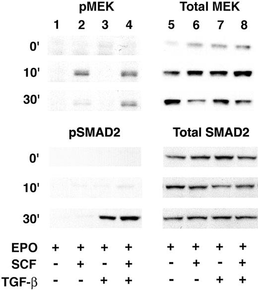 Figure 5. MEK phosphorylation studies. Western analyses for phosphorylated MEK1/2 (pMEK; upper left), total MEK1/2 (Total MEK; upper right), phosphorylated SMAD2 (pSMAD2; lower left), or total SMAD2 (Total SMAD2; lower right) are shown. Total protein (25 μg/well) was extracted from culture day-7 cells harvested at 0 (top row), 10 (middle row), and 30 (bottom row) minutes after the addition of SCF or TGF-B (denoted by + at the bottom of the figure).