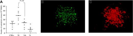 Figure 5. Follow-up study and phenotype of endothelial colonies from patients with AMI. Number of endothelial colonies obtained from PBMCs of healthy controls (CTRLs) or patients with AMI tested at T0, 24 hours, (24h), and 7 days (7d) after onset of AMI (A); the lines represent the median values. Panels B and C show an endothelial colony coexpressing both VE-cadherin (B; green) and CD31 (C; red) antigens. Specimens were stained by indirect immunolabeling using secondary antibodies conjugated with AlexaFluor-988 (green) or AlexaFluor-594 (red) fluorochromes (Molecular Probes, Eugene, OR). Mowiol4-88 (Calbiochem, La Jolla, CA) was used for mounting medium. Micrographs were captured using an Olympus IX71 inverted microscope (Olympus Europa GmbH, Hamburg, Germany) equipped with a CPlan F1 10×/0.30 objective, an Olympia Camedia C-3030 zoom with a 3× optical plus 2.5× digital zoom (Olympus), and Camedia Master 2.0 software (Olympus). Original magnification, × 250.