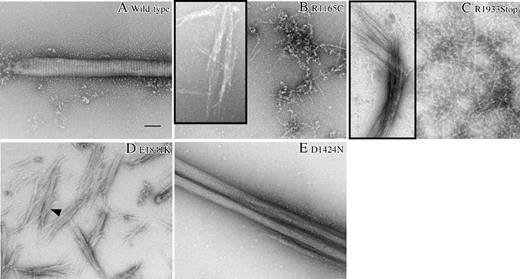 Figure 2. Negative staining and electron microscopy of MYH9 mutant tail fragments. Negative staining and electron microscopy reveal aberrant paracrystal morphology in MYH9 mutant tail fragments. The insets show extremely rare examples and represent the best structures observed. The scale bar is 100 nm. (A) The wild-type tail fragment formed paracrystals with expected morphology. They were large and well-ordered and had uniform periodicity throughout the paracrystal. (B) The R1165C tail fragment is unable to form paracrystals or any other type of large assembly. Instead, we found chainlike structures in a random array. On extremely rare occasions, we found faint examples of assemblies (shown in the inset), but they lacked size, uniformity, and periodicity. (C) The R1933Stop tail fragment predominantly formed chainlike structures similar to R1165C; however, a few paracrystallike assemblies were observed (inset). These lacked size, uniformity, and periodicity. (D) For E1841K, chainlike structures were often observed; however, we also found paracrystals with very different morphology compared with wild-type. Not only are these structures very short in length, but they appear to fray apart at the ends. Periodicity can be found only in the central region of some paracrystals (arrowhead). (E) The D1424N tail fragment assembled into paracrystals (the best example is shown), which were wild type in size, but had altered periodicity.