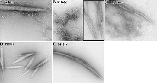 Figure 3. Mixing wild-type and mutant tail fragments. Mixing wild-type and mutant tail fragments demonstrates these mutations have a dominant activity. First, 100 μg wild-type and each mutant tail fragment were mixed in high salt and then dialyzed into low salt to induce paracrystal formation. Scale bar = 100 nm. (A) Wild-type tail fragment alone formed large well-ordered paracrystals with uniform periodicity. (B) Mixing R1165C with wild type, we found a large number of chainlike structures. Occasionally, small assemblies were observed (inset); however, they lacked size and organization. (C) Mixing R1933Stop with wild type, we typically found chainlike structures; however, on rare occasions we observed assemblies. These structures were short with little to no sign of periodicity. (D) Mixing E1841K with wild type, we sometimes found chainlike structures but most often found very short paracrystals with frayed ends—similar to E1841K alone. (E) Mixing D1424N with wild type, we routinely found paracrystals with morphology similar to that of wild type. Periodicity was normal; however, the mixed paracrystals appeared narrower than wild-type ones. Note that this image shows 2 or 3 paracrystals lying next to one another.
