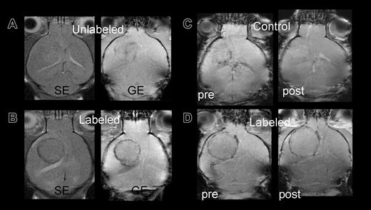 Figure 3. Control versus labeled mice: group 3 mice imaged at day 10 after cell transplantation. (A) Signal intensity in tumor of control mouse with unlabeled cells on either spin echo (SE) or gradient echo (GE) sequences are almost isointense with contralateral hemisphere. (B) Mouse receiving FE-PLL-labeled cells demonstrates clear ring at the tumor periphery on both SE and GE. (C-D) Post-Gd-DTPA contrast-enhanced MRIs to differentiate between slow blood flow in patent vessels at the tumors' edge and the presence of magnetically labeled cells. The hypointense area in a group 2 control mouse (C) that received killed labeled cells becomes isointense with surrounding brain after contrast, indicating the Gd-DTPA in the area increased the signal intensity, whereas the dark ring persists in the mouse with labeled cells (D).