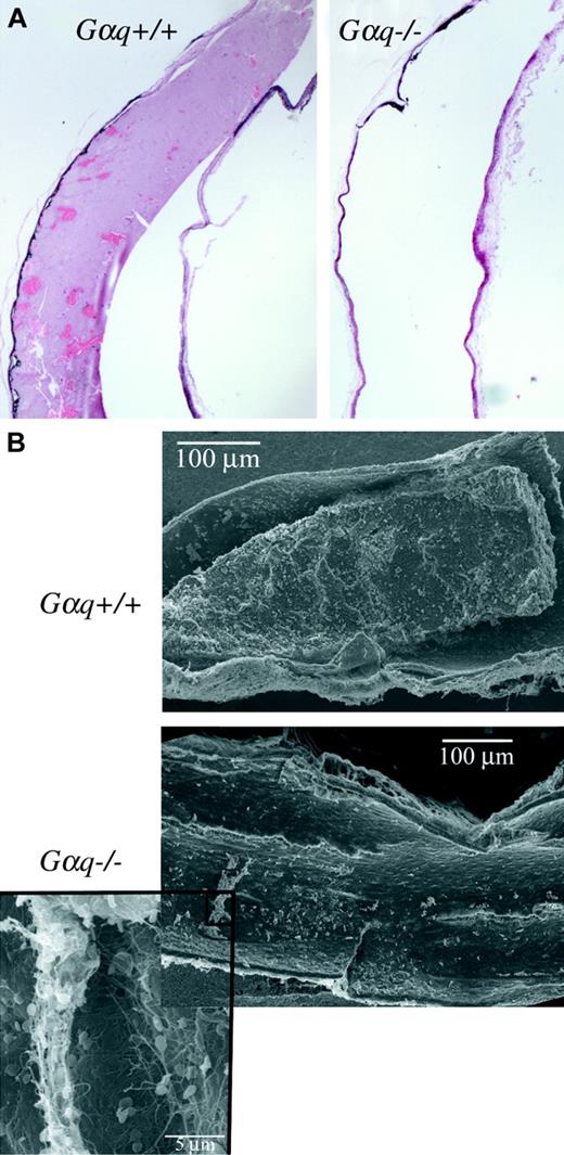 Figure 1. Gαq–/– platelets fail to support thrombus formation in vivo. Carotid vessels of wild-type and Gαq–/– mice were injured by the application of 20% FeCl3 and thrombus formation analyzed by real-time intravital videomicroscopy (data not shown), histologic analysis (A), and scanning electron microscopy (B) 30 minutes after the initial challenge. Light microscopy of hematoxylin/eosin-stained sections revealed well-developed, occlusive thrombi within the carotids collected from wild-type mice, whereas vessels from Gαq–/– mice were effectively clear (representative views in panel A). Original magnification × 2. Electron micrographs of carotid arteries cut longitudinally to view the luminal contents (representative views in panel B) revealed densely packed thrombi in wild-type mice. In contrast, no occlusive thrombi were observed in the lumen of vessels from Gαq–/– mice. Rather, only trace amounts of fibrin-trapped platelets and red cells were observed (inset). Original magnifications × 100 and × 2000 (inset).