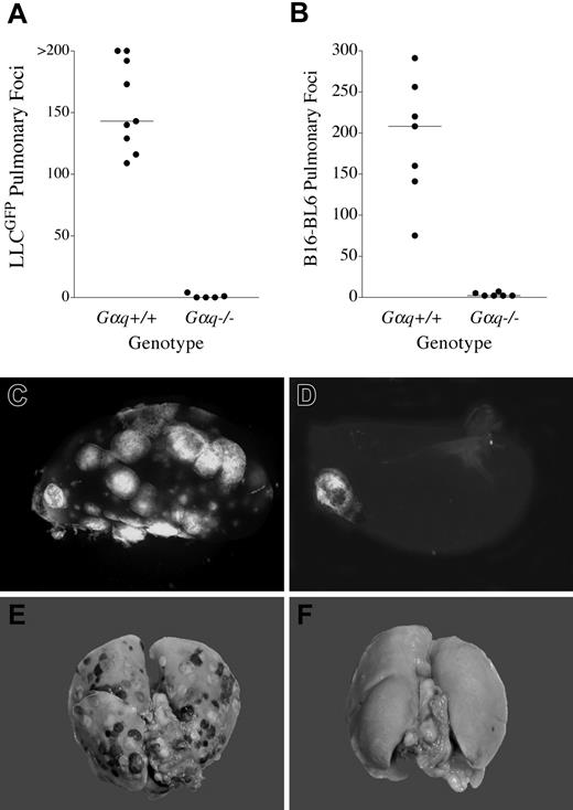 Figure 2. Gαq deficiency dramatically diminishes the metastatic potential of circulating tumor cells. Quantitative analysis of experimental pulmonary metastases in wild-type and Gαq–/– mice following intravenous injection of 4.5 × 105 LLCGFP cells (A) or 8 × 104 B16-BL6 melanoma cells (B). The data shown represent the total number of surface pulmonary foci observed on all lung lobes for each mouse injected. The horizontal bars represent median values; P < .005 for each comparison using a Mann-Whitney U test. Gross appearance of pulmonary metastatic foci in animals injected with either LLCGFP cells (representative views in panels C-D) or B16-BL6 (representative views in panels E-F) tumor cells. Note that the number of LLCGFP tumor foci (detected based on GFP fluorescence) was dramatically higher in control mice (C) relative to Gαq–/– mice (D) but the size of individual lesions was similar. Images were obtained with a fluorescence-equipped Leica MZFL III stereomicroscope (Leica, Bannockburn, IL) equipped with an RTKE digital camera (RTKE Diagnostics, Sterling Heights, MI). SPOT RT software v. 3.5 was used to acquire images (RTKE Diagnostics). Similarly, high numbers of B16 melanoma lesions (detected based on melanin content) were seen in control mice (E) but not Gαq–/– mice (F).