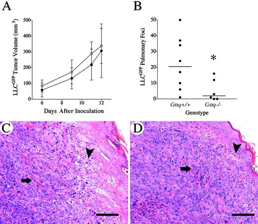 Figure 4. Platelet activation is a significant determinant of spontaneous metastasis but not tumor growth. (A) Serial measurements of tumor volume after transplantation of LLCGFP cells into the dorsal subcutis of control (•, n = 9) and Gαq–/– mice (○, n = 8). There was no significant difference in tumor volumes between wild-type and mutant mice at any time point. Data shown are means with standard deviations. (B) Quantitative analysis of spontaneous pulmonary metastases. Metastatic foci were enumerated 14 days after primary tumor irradiation. Note that spontaneous metastasis, like experimental metastasis, was significantly diminished in Gαq-deficient mice. Horizontal bars indicate median values; *P < .03, Mann-Whitney U test. No genotype-dependent difference was observed in overall primary tumor architecture based on histologic analyses of subcutaneous LLCGFP tumors from control (representative data in panel C) and Gαq–/– (representative data in panel D) mice. Note that tumor cell invasion into overlying dermal structures (arrowheads) and numerous blood vessels (arrows) were observed in tumors harvested from mice of both genotypes. The horizontal bars denote 100 μm. Photomicrographs were obtained using a Zeiss Axioplan 2 microscope equipped with a 20×/0.75 objective lens and an Axiovision digital camera (Zeiss, Oberkochen, Germany). Axiovision software was used to acquire images (Zeiss).