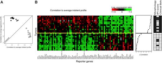 Figure 2. Supervised classification of 12 paired lymphoma samples (training series). (A) Correlation plot of the FL stratification profile. Correlation of the expression profile of each tumor sample with the average expression profile of all indolent samples is depicted on the horizontal axis, and the correlation of the expression profile of each tumor with the average expression profile of all aggressive tumor samples is shown on the vertical axis. Tumors classified above the threshold are classified as molecular high-grade; tumors below the threshold are classified as molecular low-grade. (B) Expression data matrix of 81 marker genes from tumors of the indolent as well as the aggressive phase of 12 patients with FL. Each row represents a tumor and each column a gene. Genes are ordered on the basis of their SNR. Tumors are rank ordered according to the difference in correlation with the average high-grade profile and the correlation with the low-grade profile (middle panel). The solid yellow line is the classifier with optimal accuracy; patients above the yellow line have an aggressive disease course; below the yellow line, they have an indolent disease course at the disease episode at the time of biopsy. Selected clinical data are shown in the right panel. For morphologic data, □ indicates FL grade 1 or 2; ▪ indicates FL grade 3b or DLBCL. IPI scores and clinical behavior at time of biopsy are as described in Figure 1.