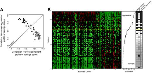 Figure 3. Correlation and pattern of expression of genes used to determine the clinical characteristics of 58 lymphoma samples (independent validation series). (A) Correlation plot of the FL stratification profile. Correlation of the expression profile of each tumor sample with the average expression profile of all low-grade samples of the training series is depicted on the horizontal axis, and the correlation of the expression profile of each tumor with the average expression profile of all high-grade tumor samples of the training series is shown on the vertical axis. Tumors classified above the threshold are classified as molecular high-grade; tumors below the threshold are classified as molecular low-grade. (B) Expression data matrix of 81 marker genes from tumors of the indolent as well as the aggressive phases of patients with FL. Each row represents the FL stratification profile for one tumor. Each column represents the relative expression of one gene. The genes in the horizontal direction are arrayed in the same order as in Figure 2B. Tumors are rank-ordered according to the difference in correlation with the average aggressive profile and the correlation with the low-grade profile of the training set (middle panel). The yellow line is the threshold as determined in Figure 2 (see Figure 2 for color scheme). In the panel on the right morphologic and clinical features are shown of the samples similar to features shown in Figure 2B. Of the 58 samples, 4 were misclassified (93% accuracy).