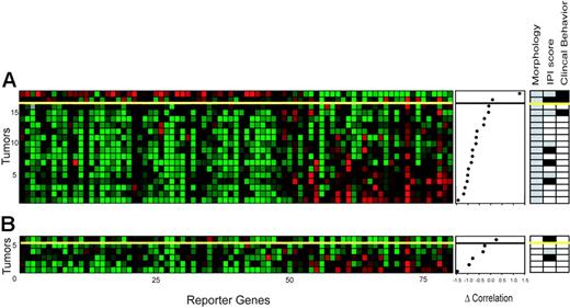 Figure 4. Pattern of gene expression of genes used to determine the clinical characteristics of 24 FL samples (test series). (A) The expression data matrix of 18 tumor samples with an unclear morphology across the 81 gene profile. The genes in the horizontal direction are arrayed in the same order as in Figure 2B. Tumors are rank ordered according to the difference in correlation to the molecular high-grade and low-grade profile as in Figure 2 (middle panel). The yellow line is the threshold as determined in Figure 2B (see Figure 2 for color scheme). Morphologic data, IPI scores, and clinical behavior are shown on the right. □, , and ▪ are as indicated in Figure 1B. Of the 18 samples, the classifier predicted the actual clinical behavior correctly in 17 patients (accuracy 94%). (B) Expression data of 6 tumor samples from patients with unequivocal morphologic and clinical indolent disease, but who presented with full-blown aggressive disease within 10 months. One sample was classified as molecular high-grade.