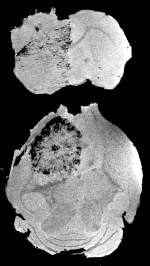 Serial MRI in mice that received magnetically labeled Sca1+ bone marrow cells, group 2. See the complete figure in the article beginning on page 420.