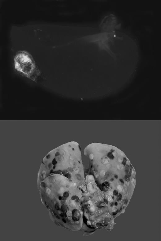 Gαq deficiency dramatically diminishes the metastatic potential of circulating tumor cells. See the complete figure in the article beginning on page 178.