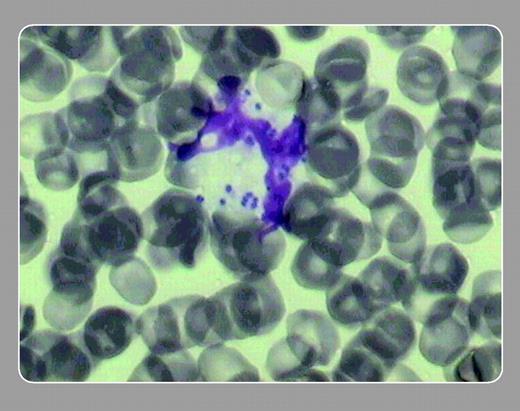 Jaime Ferrer Cañabate and José M. Zarauz, Hospital Rafael Méndez, Lorca, Spain