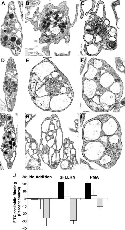 Figure 3. Effects of cytochalasin E and latrunculin A on platelet ultrastructure and F-actin formation. Platelets were incubated in the presence of vehicle (A-C), 4 μM cytochalasin E (D-F), or 4 μM latrunculin A (G-I) for 20 minutes. Actin-disrupting agents had little effect on the morphology of resting platelets. (B) Platelets treated with SFLLRN for 10 minutes demonstrated pseudopod formation. A subpopulation demonstrated granule centralization but most showed only marked degranulation. Pretreatment with (E) cytochalasin E or (H) latrunculin A inhibited pseudopod formation. The OCS becomes expanded and enlarged under these conditions. (C) Platelets treated with PMA for 20 minutes demonstrated degranulation and pseudopod formation. Pretreatment with (F) cytochalasin E or (I) latrunculin A prevented formation of pseudopodia and resulted in enlargement and expansion of the OCS. (J) Platelets were incubated in the presence of vehicle (▪), 4 μM cytochalasin E (□), or 4 μM latrunculin A (▦) for 20 minutes. Platelets were then stimulated with buffer alone, SFLLRN for 10 minutes, or PMA for 20 minutes. Platelets were subsequently fixed and stained with 10 μM FITC-phalloidin in the presence of 0.1% Triton X-100. Fluorescence was then quantified by flow cytometry. Data are expressed as percentage of change in FITC fluorescence compared with samples exposed to buffer alone. Magnification of panels A, D, F, and I is 22 000 ×; B and E, 18 000 ×; C, 26 500 ×; G, 17 000 ×; and H, 15 000 ×.