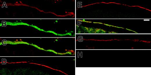 Figure 4. Colocalization of band 3 and 4.2 in Xenopus oocytes. Band-3 (0.5 ng) cRNA alone or B3 with 1.5 ng protein 4.2 or protein-4.2 variant cRNA were injected into Xenopus oocytes; these oocytes were processed for confocal imaging as described in “Materials and methods.” The sections were incubated sequentially with mouse monoclonal anti–band-3 antibody BRIC155, then rabbit anti–protein-4.2 antibody diluted 1:500, and these primary antibodies were detected using a goat antirabbit antibody conjugated to Alexa488 and a goat antimouse antibody conjugated to Alexa546. The micrographs in panels A-C were taken from the same oocyte coexpressing band-3 and 4.2 with (A) band-3 imaged with Alexa546 (red; B), 4.2 Alexa488 fluorescence (green; C), merged image of B3 (A) and 4.2 (B) showing colocalization at the plasma membrane (yellow). The images in panels D-F and H are the corresponding merged images for (D) band-3 and 4.2 Tozeur, (E) band-3 and 4.2 Komatsu, (F) band-3 and 4.2 Nippon, and (H) uninjected oocyte control. The image in panel G shows a section of an oocyte injected with band-3 alone, incubated with BRIC155, and then detected with anAlexa546 secondary. Only protein 4.2 (C) and protein 4.2 Nippon (F) colocalized with B3 at the plasma membrane. Scale bar = 10 μM.
