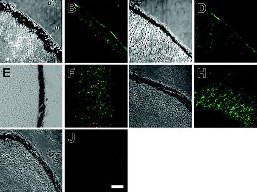 Figure 5. Protein 4.2 localizes to the plasma membrane in Xenopus oocytes. The cRNAs corresponding to normal protein 4.2 and protein 4.2 Nippon were injected alone into Xenopus oocytes and then processed for confocal imaging as described in “Immunofluorescence and confocal microscopy.” The oocyte sections were incubated with the rabbit anti–protein-4.2 antibody (diluted 1:500) and detected using a goat antirabbit antibody conjugated to Alexa488. Panels A, C, E, G, and I are bright field images and panels B, D, F, H, and J are corresponding fluorescent images. (A-B) Injected with 1.5 ng normal protein-4.2 cRNA, (C-D) injected with 1.5 ng protein 4.2 Nippon cRNA, (E-F) injected with 1.5 ng protein 4.2 Tozeur cRNA, (G-H) injected with 1.5 ng protein 4.2 Komatsu cRNA, and (I-J) uninjected oocyte control. Both protein 4.2 and protein 4.2 Nippon had immunoreactive protein localized to the plasma membrane in oocytes. The majority of protein 4.2 Tozeur and protein 4.2 Komatsu immunostaining was intracellular, with very little present at the oocyte plasma membrane. No protein-4.2 staining was observed in control oocytes. Scale bar in panel K = 30 μM.