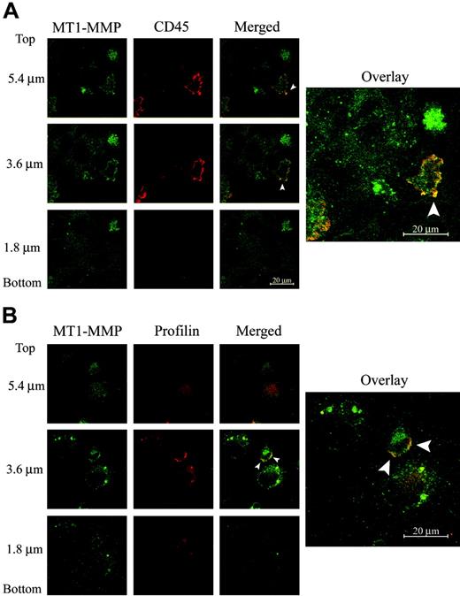 Figure 4. MT1-MMP is enriched at the leading edge of monocytes migrating on activated endothelial cells. (A) MT1-MMP (green) and CD45 (red) were stained in fresh monocytes adhered for 2 hours in the presence of 100 ng/mL MCP-1 to endothelial cells previously stimulated with 20 ng/mL TNF-α for 12 hours. Selected confocal sections and the merged overlay of all sections are presented. Arrowheads indicate areas where MT1-MMP and CD45 colocalize at monocyte membrane ruffles. (B) MT1-MMP (green) and profilin (red) were stained in fresh monocytes adhered for 2 hours in the presence of 100 ng/mL MCP-1 to endothelial cells previously stimulated with 20 ng/mL TNF-α for 12 hours. Selected confocal sections and the merged overlay of all sections are presented. Arrowheads indicate areas where MT1-MMP and profilin colocalize at monocyte leading edge.