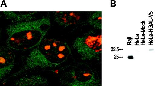 Figure 1. Localization of HGAL protein and specificity of anti-HGAL monoclonal antibody. (A) Confocal immunofluorescence microscopy using a FITC-conjugated anti-V5 antibody in transfected HeLa cells shows that the HGAL protein is localized to the cytoplasm (green fluorescence). The nuclei are counterstained with an orange Hoechst dye (original magnification, ×1000). (B) Western blot analysis using the anti-HGAL monoclonal antibody shows a specific band corresponding to HGAL protein expression in Raji cells (positive control) and in HeLa cells stably transfected with pcDNA3.1 HGAL-V5 but not in native or mock-transfected HeLa cells.
