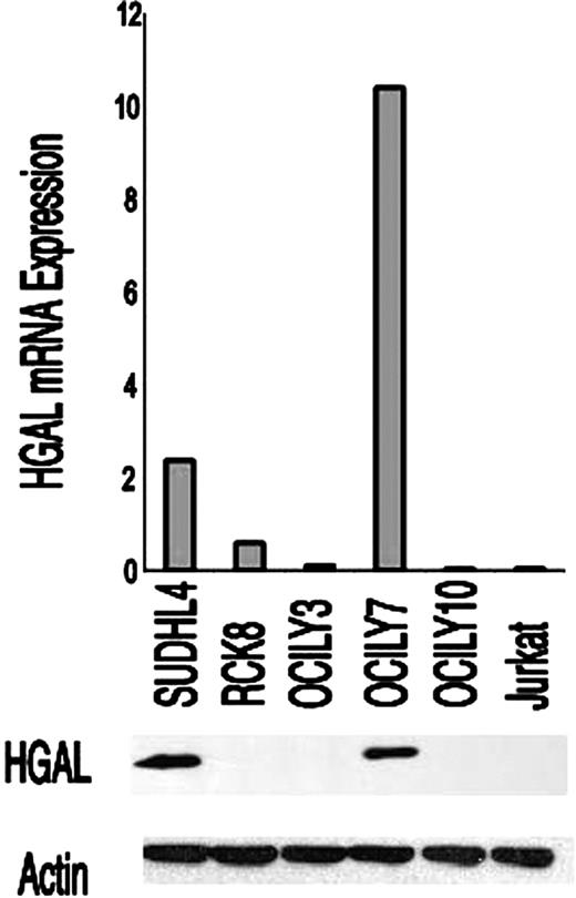 Figure 2. Correlation between HGAL mRNA and protein expression. HGAL mRNA and protein expression were assessed by real-time RT-PCR and Western blot using the anti-HGAL antibody, respectively, in GC-like (SU-DHL-4, OCI-LY7) and in non–GC-like (RCK8, OCI-LY3, OCI-LY10) DLBCL cell lines and in the Jurkat T-cell line. Actin was used as a loading control.
