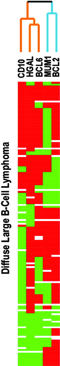 Figure 6. Hierarchical clustering of protein expression data. The expression patterns of 5 proteins, HGAL, CD10, BCL6, MUM1/IRF4 (MUM1), and BCL2, predicted to be associated with distinct subtypes of DLBCL based on the cell of origin by gene expression profiling studies are shown. Positive staining is indicated as red and the lack of staining as green. Stains that were not interpretable are indicated in white. The branching pattern of the dendrogram reflects similarities in the patterns of reactivity of the antibodies, with short branches denoting a high degree of similarity in expression pattern of the cognate protein across 151 DLBCL cases. HGAL clusters with BCL6 and CD10, associated with a GC phenotype, on one branch of the dendrogram (indicated in orange), whereas MUM1 and BCL2, associated with an ABL phenotype, cluster on a separate branch (indicated in blue).