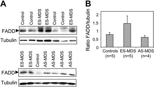 Figure 3. Increased endogenous FADD in ES-MDS erythroid precursors. (A) Immunoblotting analysis of FADD in erythroid precursors from healthy controls (n = 5), ES-MDS (n = 5), and AS-MDS (n = 4) on culture day 10. (B) Densitometry analysis of FADD and tubulin immunoblots expressed as mean ratios ± SEM of FADD to tubulin expression in each group of patients.