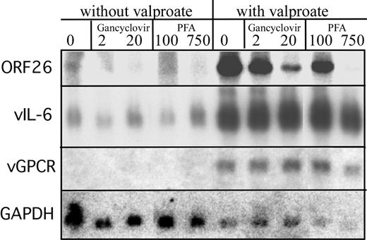 Figure 3. The changes in viral gene expression resulting from incubation with ganciclovir or PFA in the absence and presence of valproate. BCBL-1 cells were incubated in the absence or presence of valproate (0.6 mM) in medium that contained the indicated concentration of ganciclovir or PFA (μM). After a 4-day incubation, total cellular RNA was isolated, and 20 μg RNA of each sample was size fractionated and analyzed by Northern blot analysis for the indicated transcripts. The nitrocellulose was stripped with boiling water prior to each hybridization.