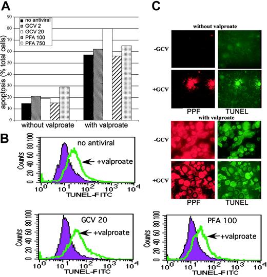Figure 5. Apoptosis resulting from valproate, ganciclovir, and PFA. BCBL-1 cells were incubated in the absence or presence of valproate (0.6 mM) for 3 or 4 days. Where indicated, ganciclovir (GCV) or PFA was present throughout the incubation at the indicated concentration (μM). Cells were assessed for the percentage of apoptotic cells using the TUNEL assay with flow cytometry. (A) The percentage of the total cells that were apoptotic after a 3-day incubation is graphically shown for each condition. ▪ indicates cells not treated with an antiviral agent; ▧, 2 μM GCV; □, 20 μM GCV; ▨, 100 μM PFA; and ▦, 750 μM PFA. (B) Representative flow cytometric profiles are shown for cells incubated in the absence (filled curve) and presence (open curve) of valproate in combination with the indicated antiviral agent. (C) Cells were fixed and processed for dual immunofluorescence looking at the early lytic viral protein PPF and for TUNEL. Filters were used that selectively detected either the red using Alexa Fluor 567 (PPF) or green using fluorescein isothiocyanate (FITC) (TUNEL) fluorescence. Where indicated, ganciclovir was present at 20 μM.