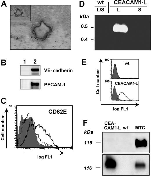 Figure 1. Characterization of wild-type and CEACAM1-L–transfected rat brain endothelial (RBE) cells. (A) Immunohistochemistry of vascular endothelia in rat meninges using rat CEACAM1-specific monoclonal antibody Be9.2 or isotype control IgG (insert in the upper left); representative staining of a cross-section is shown. Original magnification, × 10. (B) Expression of VE-cadherin and PECAM-1 in RBE cells. Immunoblotting of cell lysates (50 μg) of (lane 1) IEC-6 (small intestine epithelial cells, negative control) or (lane 2) RBE cells. (C) Flow cytometric detection of E-selectin on the surface of RBE cells. Isotype control IgG staining of untreated cells (gray shading), anti–E-selectin staining of untreated cells (–), or 20-hour TNF-α–treated cells (—). (D) Detection of CEACAM1 mRNA by RT-PCR in wild-type (wt) and CEACAM1-L–transfected RBE cells (CEACAM1-L); the primer combinations recognized all isoforms of rat CEACAM1 (L/S), the long isoform specifically (L), or the short isoform specifically (S). (E) Cell surface expression of CEACAM1-L after transfection. Wt (top) or CEACAM1-L–transfected and cloned cells were incubated with isotype control (gray shading) or mAb Be9.2 (—) and FITC-coupled secondary antibody for flow cytometric analysis. (F) Detection of soluble and membrane-bound CEACAM1-L. Immunoprecipitated soluble isoforms of CEACAM1 from cell culture supernatants (top) or membrane-bound CEACAM1 (bottom) of rat RBE and MTC cells detected by immunoblotting with mAb Be9.2. A representative immunoblot of 3 independent experiments is shown.