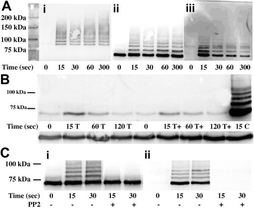 Figure 2. The ubiquitination of Syk in activated human platelets. (A) Syk was immunoprecipitated from RIPA-lysed platelets that had been activated with convulxin for the indicated times. The immunoprecipitates were separated by SDS-PAGE and transferred to Immobilon. The blot was first probed for ubiquitin (antibody P4D1; Ai). This blot was stripped and probed for Syk (Aii). The same samples were run on another gel and transferred to Immobilon and probed for phosphotyrosine (Aiii). (B) Syk was immunoprecipitated from lysates of activated platelets with thrombin (T, lanes 2-4), thrombin plus SC57101 (T+, lanes 6-8), or convulxin (column 9) and probed for phosphotyrosine. (C) Platelets were preincubated for 10 minutes with 20 μM PP2 as indicated prior to activation with convulxin. Syk was immunoprecipitated and the blots were probed either for Syk (Ci) or for phosphotyrosine (Cii).