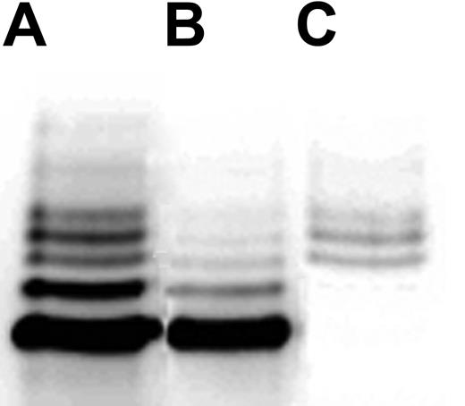 Figure 4. Separation of ubiquitinated Syk using an antiubiquitin antibody. Washed platelets were activated with convulxin (100 ng/mL) for 15 seconds. Cells were lysed with RIPA buffer and treated with FK2 antibody for 1 hour at 4°C, followed by Protein A/G PLUS-agarose for an additional hour. Supernatants were treated with anti-Syk using the same protocol. Aliquots were analyzed by Western blotting probing for Syk. Lane A shows total Syk; lane B, the second immunoprecipitate after the supernatant was treated with anti-Syk; and lane C, the material immunoprecipitated by FK2.