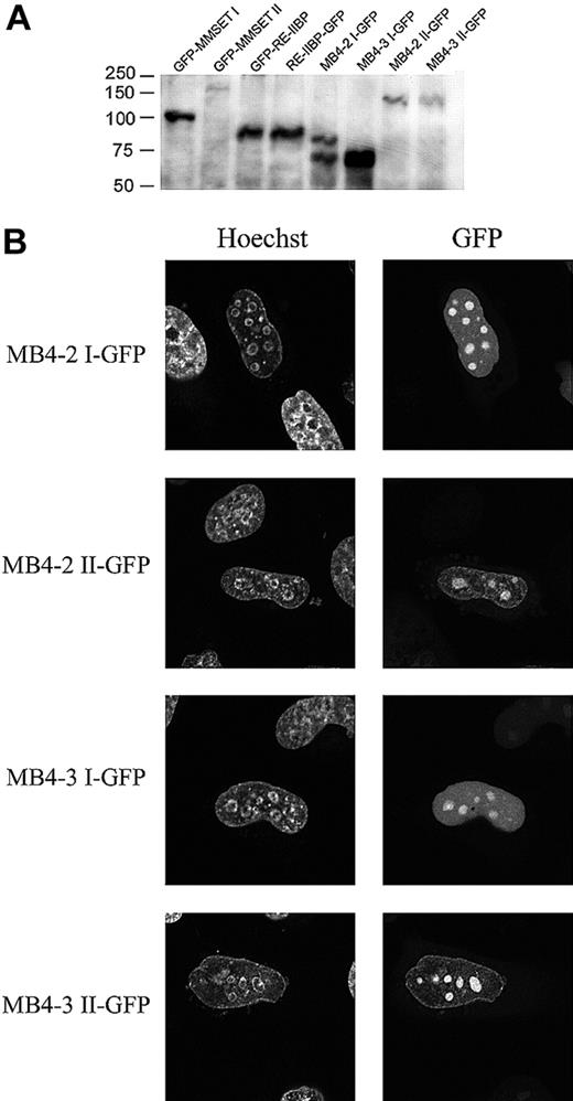 Figure 5. Alternative translation sites produce mislocalized MMSET variants. (A) Immunoblot of transiently transfected HeLa cells with various MMSET constructs. GFP-protein indicates N-terminally tagged constructs and protein-GFP indicates C-terminally tagged constructs. The detection of the predicted protein products in the C-terminally tagged MB4-2, MB4-3, and RE-IIBP constructs confirms that the alternative translation initiation sites in exon 4, 6, and 15 are functional. Interestingly, the MB4-2 construct resulted in 2 protein products, indicating that neither alternative translation site is dominant. (B) Live cell localization of type I and II constructs of MB4-2 and MB4-3 MMSET variants C-terminally tagged with GFP in transiently transfected HeLa cells. The live cell permeable DNA stain, Hoechst, is used to identify the nucleus and nucleoli. All 4 novel MMSET constructs, which are unique to the MB4-2 and MB4-3 breakpoint variants, result in proteins that enrich in nucleoli unlike the wild-type variants that are excluded from nucleoli.