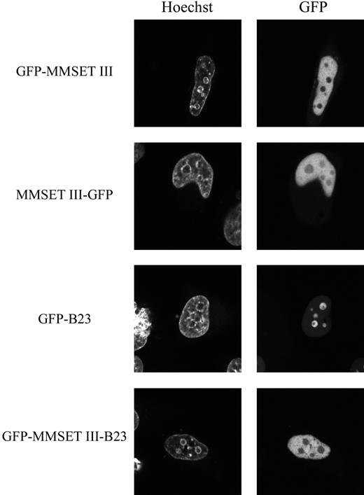 Figure 6. The N-terminus of MMSET regulates its localization pattern. Live cell localization of N- and C-terminally GFP-tagged Exon 4a/MMSET III, and N-terminally GFP-tagged B23 and MMSET III–B23 hybrid constructs, in transiently transfected HeLa cells. The live cell permeable DNA stain, Hoechst, is used to identify the nucleus and nucleoli. The Exon 4a/MMSET III construct shows a nuclear localization with nucleolar exclusion pattern. The B23 construct shows the characteristic nucleolar localization pattern, while the MMSET III–B23 hybrid construct shows the typical MMSET phenotype (nuclear and excluded from nucleoli). Immunoblotting experiments of the Exon 4a/B23 constructs confirmed that only the hybrid GFP–Exon 4a–B23 protein product is produced by this expression vector (not shown).