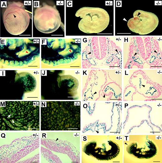 Figure 1. p110α-deficient embryos develop Tie2-/-–like vascular defects at E9.5. (A-B) Yolk sacs. Arrowhead points to a major branch of vitelline vessels. (C-D) Embryos proper. Arrowheads indicate blood congestion. (E-F) Mid-trunk region of Pik3ca+/- and Pik3ca-/- embryos. White arrowheads point to ACV (E) or to the corresponding position in the mutant at which the ACV is poorly assembled (F). Red arrowheads point to dorsal aortae. Images are focused at the level of the ACV. (G-H) Transverse sections at the level of branchial arches. Arrowheads point to ACV lumens. (I-J) X-gal–stained hearts. (K-L) Transverse sections through the center of the heart. Black arrowheads point to endocardial linings. (M-N) Whole-mount, X-gal–stained yolk sacs. Arrowhead in panel M indicates a large vessel, and arrow points to a small branch. (O-P) Histologic sections of X-gal–stained yolk sacs. Arrowhead in panel O points to a large vascular lumen. (Q-R) Transverse sections at the forebrain region of X-gal–stained embryos. Note that vascular lumens in panel R are significantly dilated and that endothelial cells are only weakly stained (arrowhead). (S-T) X-gal–stained embryos at E9.5. Arrowhead in panel T indicates weak X-gal staining signal. Images for whole-mount tissues (A-F, I, J, M, N, S, and T) were taken with a CoolSNAP CCD digital camera (Photometrics-Roger Scientific, Tucson, AZ) attached to a Leica MZFLIII stereomicroscope (Leica Microsystems, Heerbrugg, Switzerland). A single objective lens (Leica Plan 1.0, 10× magnification, Leica Microsystems) was used to obtain the images. Openlab 3.0 (Improvision, Lexington, MA) was used for initial image acquisition, and Photoshop 5.0 (Adobe Systems, San Jose, CA) was used for subsequent processing. Images for histologic sections (G, H, K, L, O, and P-R) were photographed using Carl Zeiss manufactured images products (Carl Zeiss, Göttingen, Germany), including an AxioCam CR color digital camera, AxioCam image acquisition software, a Zeiss Apochromat objective lens (63× for G, H, K, L, Q, and R; 20× for O and P), and an AxioPlan2 binocular microscope. Images in panels A-D were taken from freshly dissected embryos without staining; other specimens were stained with X-gal. All whole-mount embryo/yolk sac photographs were taken with specimens completely submerged in phosphate-buffered saline. Histological sections were counterstained with nuclear fast red. Scale bars: (A-D) 1 mm; (E-F, M-N) 400 μm; (G-H, K-L) 60 μm; (I-J) 250 μm; (O-P) 120 μm; (Q-R) 50 μm; (S-T) 500 μm.