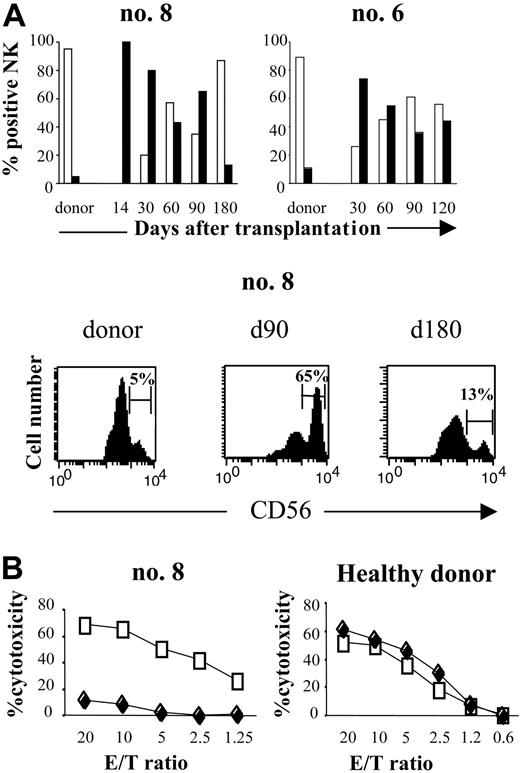 Figure 2. Distribution of CD56dim and CD56bright NK cells subsets after haploidentical SCT. (A, top) FACS profile of CD3-CD56dim (□) and CD3-CD56bright (▪) subpopulations of CD3-CD56+ NK cells in 2 patients after haploidentical SCT (no. 8, no. 6), compared with their respective donors. Percentage of NK cells is presented from the engraftment (day 14) to the sixth or fourth month after SCT. Days after transplantation are indicated. (Bottom) Flow cytometric density plots are gated on CD3-CD56+ NK cells at 90 and 180 days after transplantation and are compared with donors. Percentage of CD3-CD56dim and CD3-CD56bright cells in the total CD3-CD56+ population are indicated. (B, left) Cytotoxicity of CD3-CD56bright NK cells compared with CD56dim NK cells against K562 target cells, for patient no. 8. At engraftment (day 14), all NK cells were CD56bright (♦). These cells were collected and then activated by 100 IU/mL IL-2 for 8 days. At day 20, PB from the same patient was collected: 80% of circulating NK cells was CD56bright and 20% was CD56dim. NK cells collected at day 20 (□) were activated for 2 days with 100 IU/mL IL-2. Cytotoxicity for both NK lines was measured by 51Cr release assay against K562 target cells. (Right) NK cells from unrelated healthy donor were activated 2 days (□) and 8 days (♦) with 100 IU/mL IL-2 and tested against K562. This result is representative of 2 different experiments.