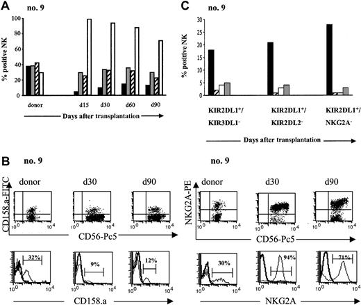 Figure 3. Pattern of inhibitory receptor expression on CD3-CD56+ NK cells after haploidentical SCT. (A) PB from donor and patient (no. 9) after SCT was stained with various inhibitory receptors: KIR2DL1 (CD158.a ▪), KIR2DL2 (CD158.b ▦), KIR3DL1 (CD158.e ▨), and CD94/NKG2A (□). Percentage of CD3-CD56+ cells positive for those receptors are represented from day 15 to day 90 and compared with donor. Days after transplantation are indicated. (B) Expression of KIR2DL1 (CD158.a) and CD94/NKG2A on NK cells from donor and patient (no. 9) after SCT. Flow cytometric density plots and histograms are gated on CD3-CD56+ NK cells. (C) Evolution of the putative alloreactive NK subset after SCT compared with the donor. Results obtained in the donor (▪) and in patient no. 9 at the engraftment (▨), day 30 (□), and day 90 (▦) after SCT are shown. The alloreactive NK subset was analyzed by 4-color flow cytometry expressed KIR2DL1 but not KIR3DL1 or KIR2DL2 or CD94/NKG2A. Results are expressed as the percentages of the alloreactive NK subset in the total NK population.